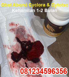 obat-penggugur-kandungan-cyclora-dan-cytotec-400-mg-untuk-kehamilan-5-6-7-8-minggu-2-bulan.jpg